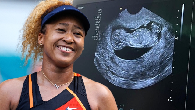 Naomi Osaka Shares First Picture Of Baby With Cordae